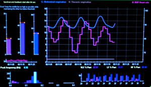 This computerized biofeedback chart shows the heart beat and respiratory waves.